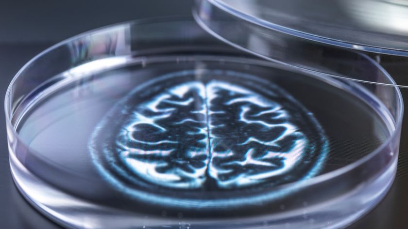 Conceptual illustration of brain organoids; Image shows a 2D brain in a petri dish.