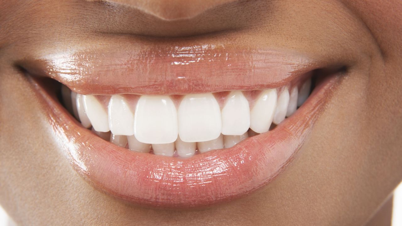 Get a perfect smile with the latest tech in dentistry