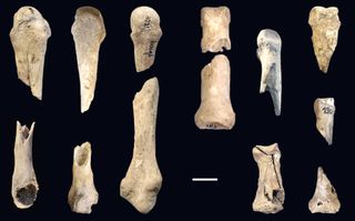 limb bones