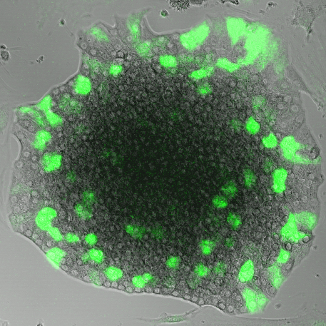 An insulin-GFP lentiviral infection of a murine islet of Langerhans.