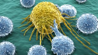 Artwork of an immune cell, in yellow, attacking a cancer cell, in blue. There are other cancer cells around them.