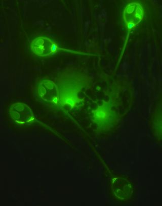 Parasitic spores glow under a fluorescent microscope.