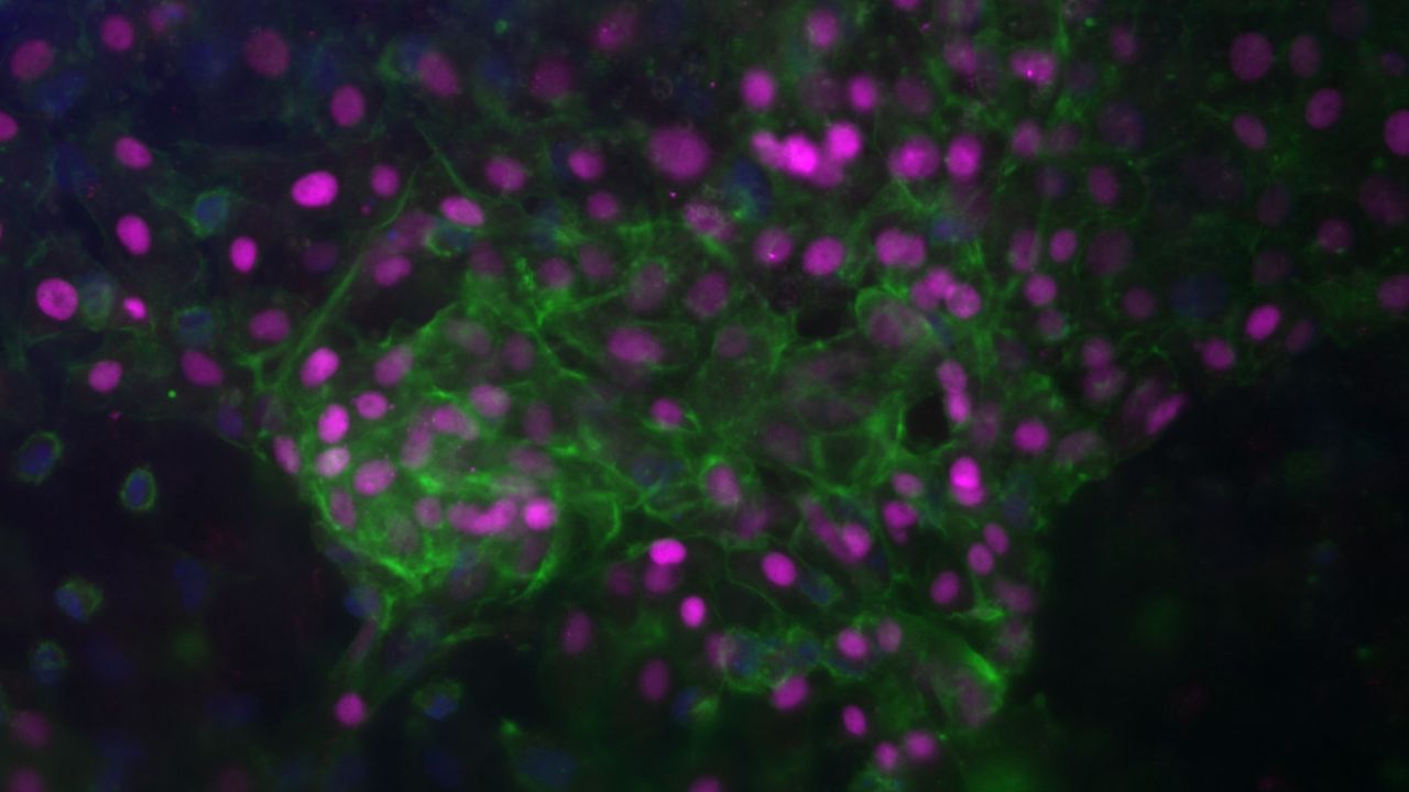 A microscope image of liver cells, shown in green and violet