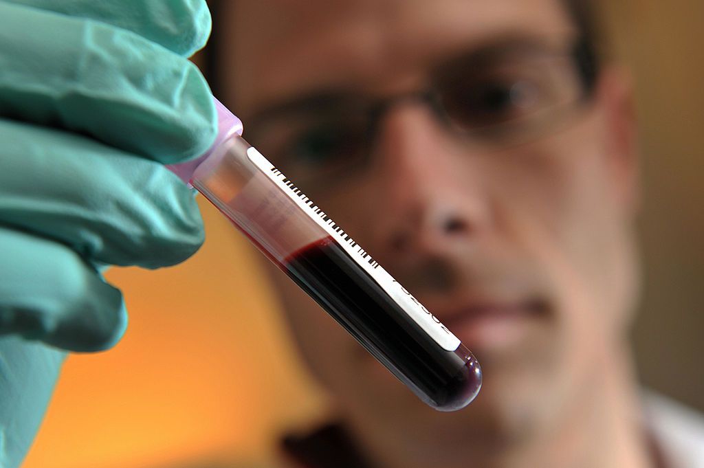 Anti-doping blood test Swiss Laboratory for Doping Analysis Neil Robinson shows a blood sample in Epalinges near Lausanne on February 25 2009 The International Cycling Union UCI promised weeks ago the first sanctions related to the biological passport but to want to make its new anti doping weapon 100 per cent reliable before the Court of Arbitration for Sport CAS Photo credit should read FABRICE COFFRINIAFP via Getty Images