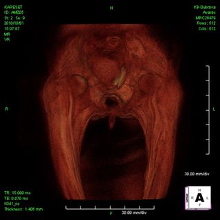 An image of the mummy's pelvic area using the new MRI technique.