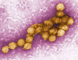Colorized transmission electron micrograph of West Nile virus