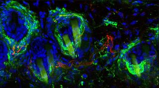 A light therapy provided pain relief to mice with neuropathic pain who had serve pain from even a gentle touch. Above, a microscopic image of the skin of a mouse, with the nerve cells that are responsible for sensitivity to gentle touch shown in green. Th