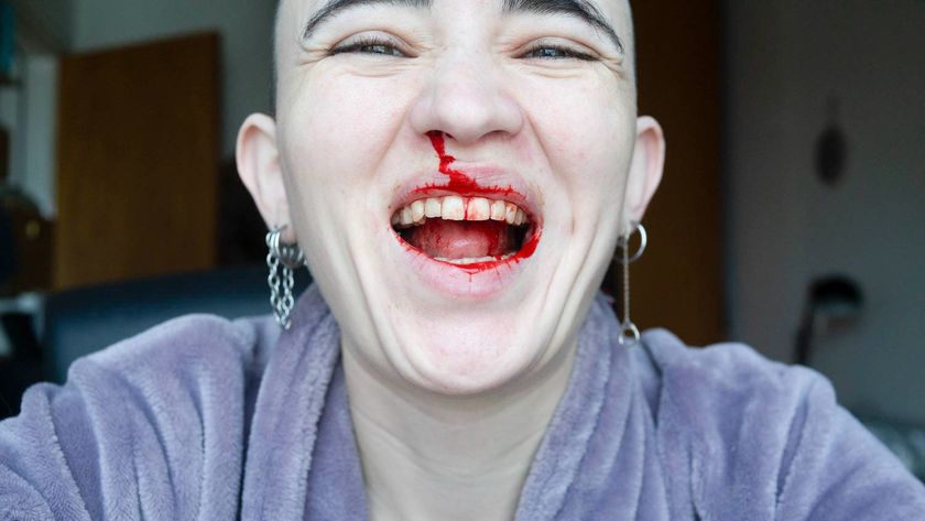 A close-up, joyful portrait of a person with a shaved head laughing broadly, with red liquid resembling blood smeared across their nose, lips, and teeth.