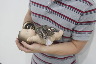 A prosthetic hand, covered with the prosthetic skin