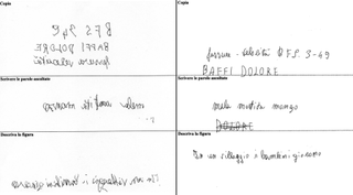 Image shows examples of the Italian patient's handwriting, who wrote normally with the right hand but wrote backwards with the left hand. 