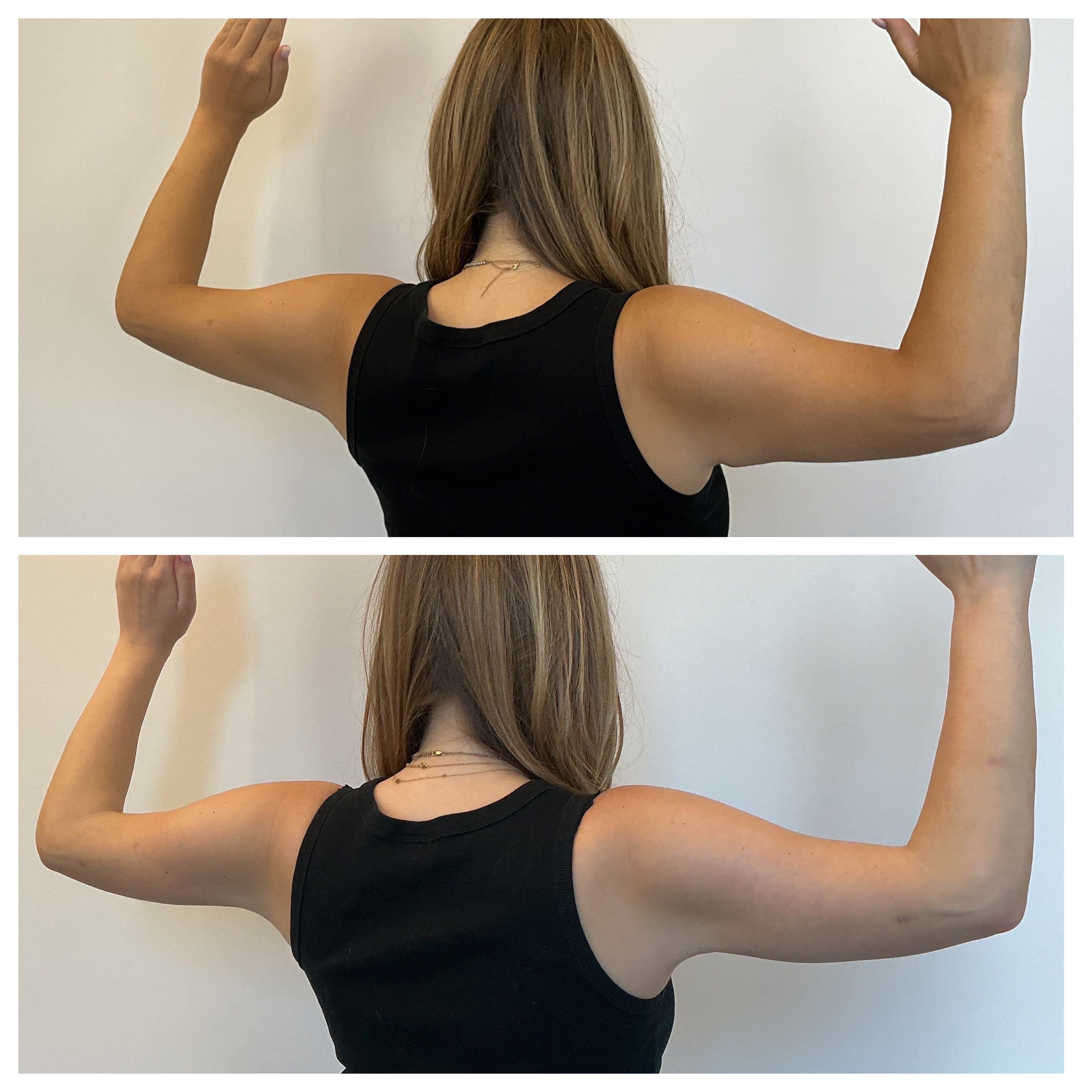 samantha holender before and after surgery