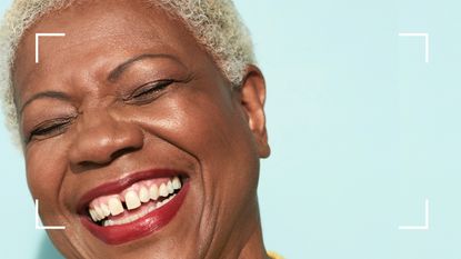 woman smiling showing teeth and gums