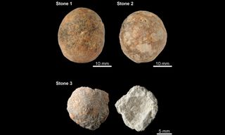 12,000-year-old prostate stones.