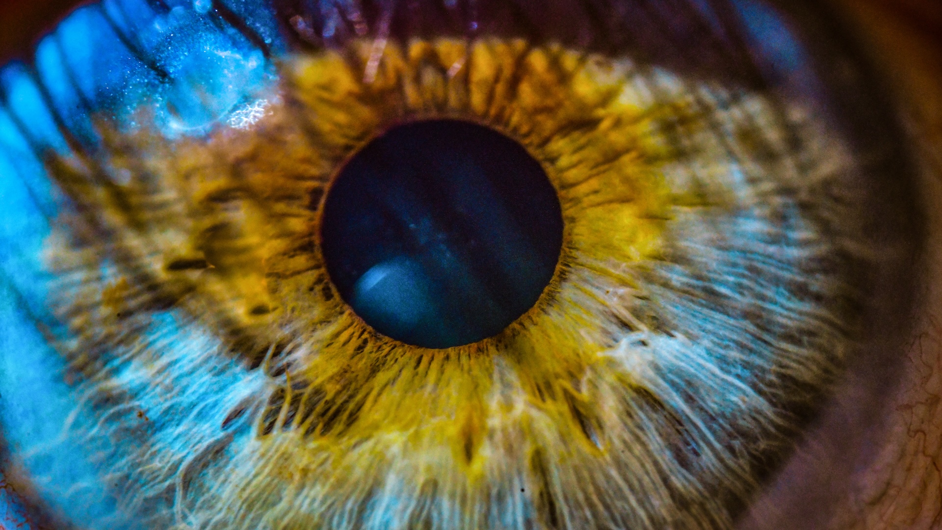 closeup of blue iris of eye, with pupil and yellow striations