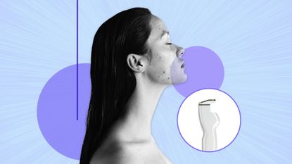 designed graphic of a woman with acne and an image of the aviclear laser device