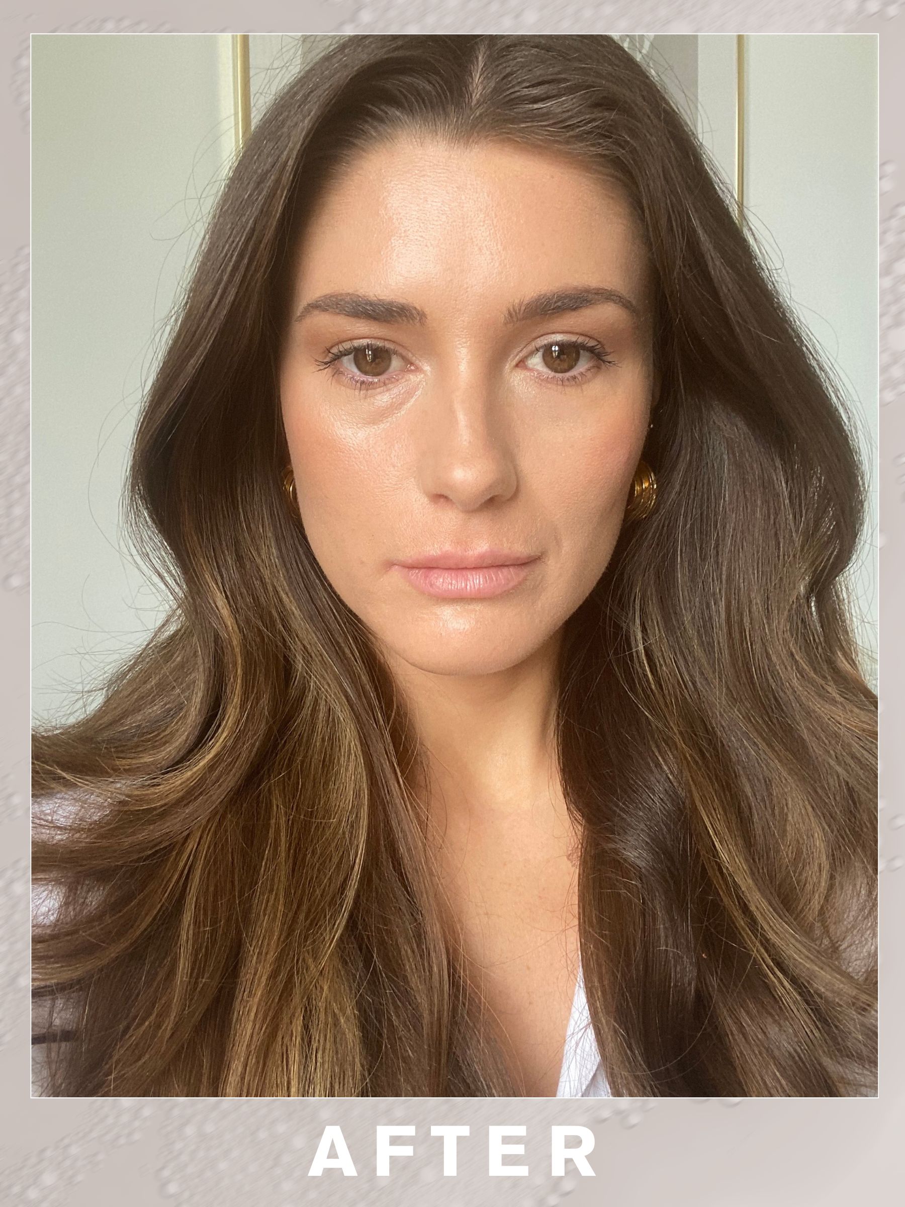 A selfie of Eleanor 4 weeks after having Botox