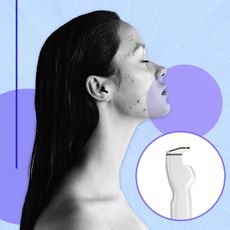 designed graphic of a woman with acne and an image of the aviclear laser device