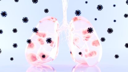 Lungs with black viruses surrounding it