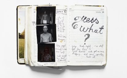 Nigel Shafran, chicken pox self portrait diary page featuring three images and handwritten notes.