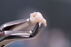 tooth, forceps