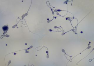 Human sperm cells