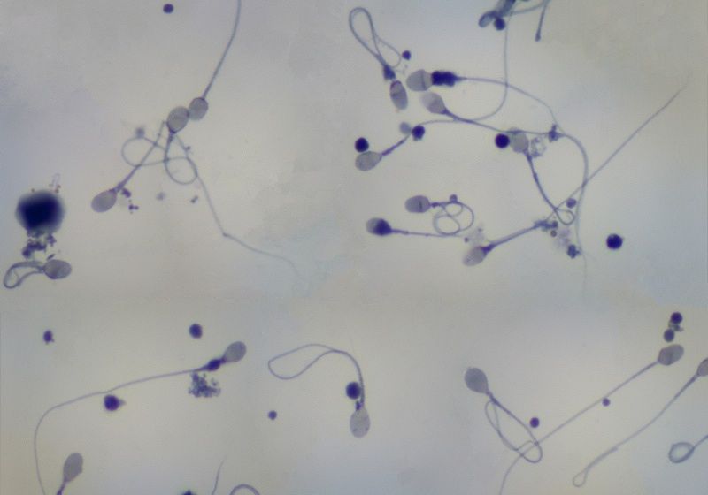 Human sperm cells