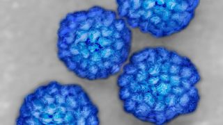 Four blue, round particles of papilloma virus are shown against a grey background