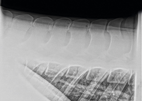 Kissing spines shown on x-ray