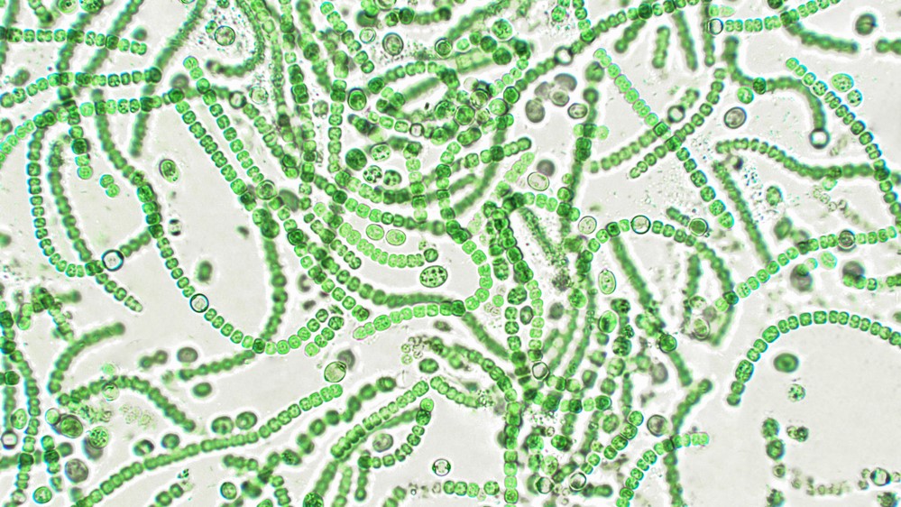 Green algae viewed under a microscope.