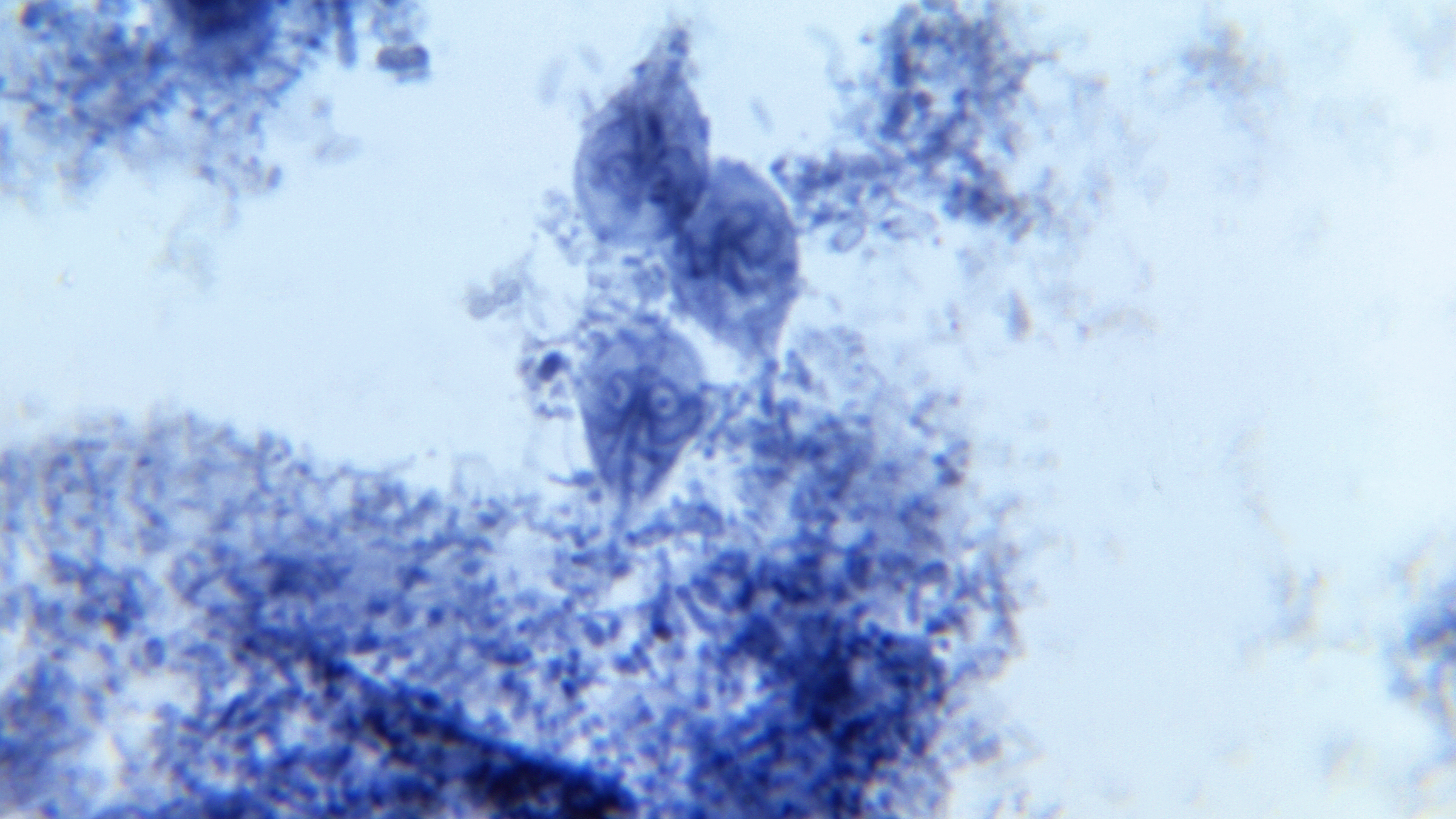 Ein vergrößertes hell- und dunkelblaues Bild des Stuhls.  Darin sind mindestens drei ohrenförmige Parasiten zu sehen.