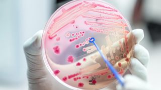 gloved hand holds up a petri dish of pink and white bacteria