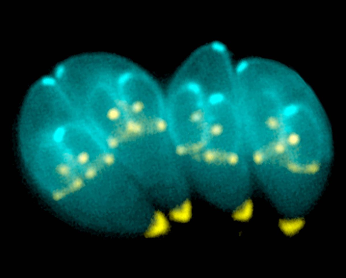 toxoplasma gondii