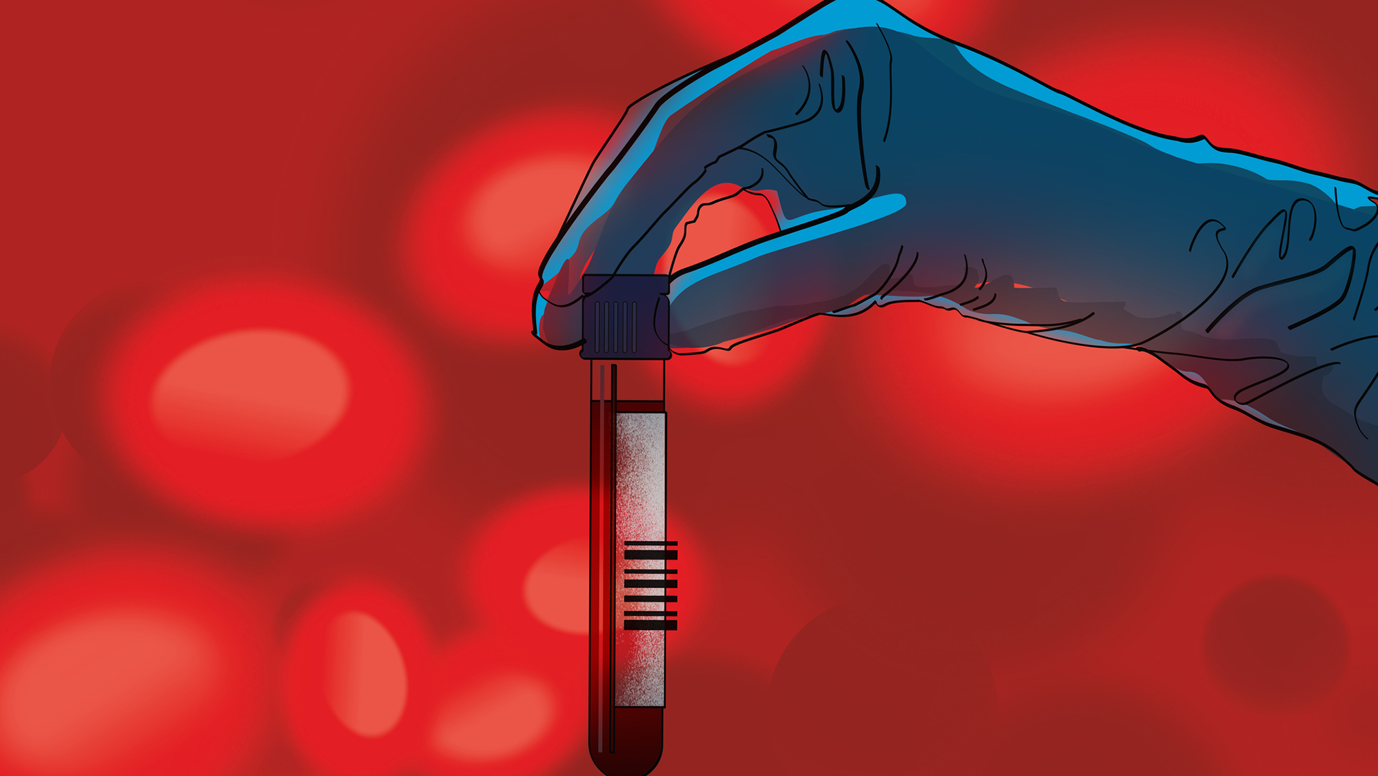 An illustration of a blue gloved hand holding up a plastic tube filled with some blood