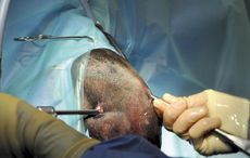 1-MAIN-blackthorn-arthroscopy.jpg
