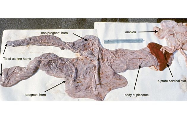 A normal placenta