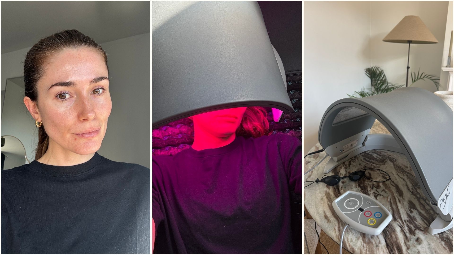 Is the Dermalux Flex MD LED Light Therapy Device Worth it? | Who
