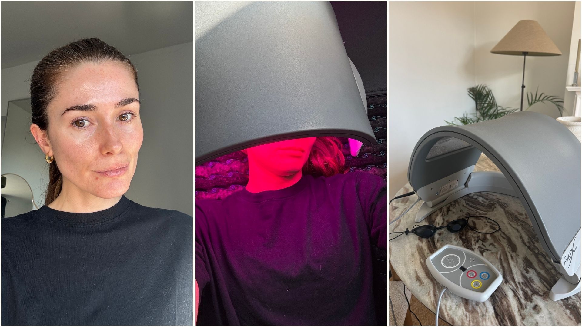 A collage with beauty editor Eleanor testing the Dermalux MD LED Device