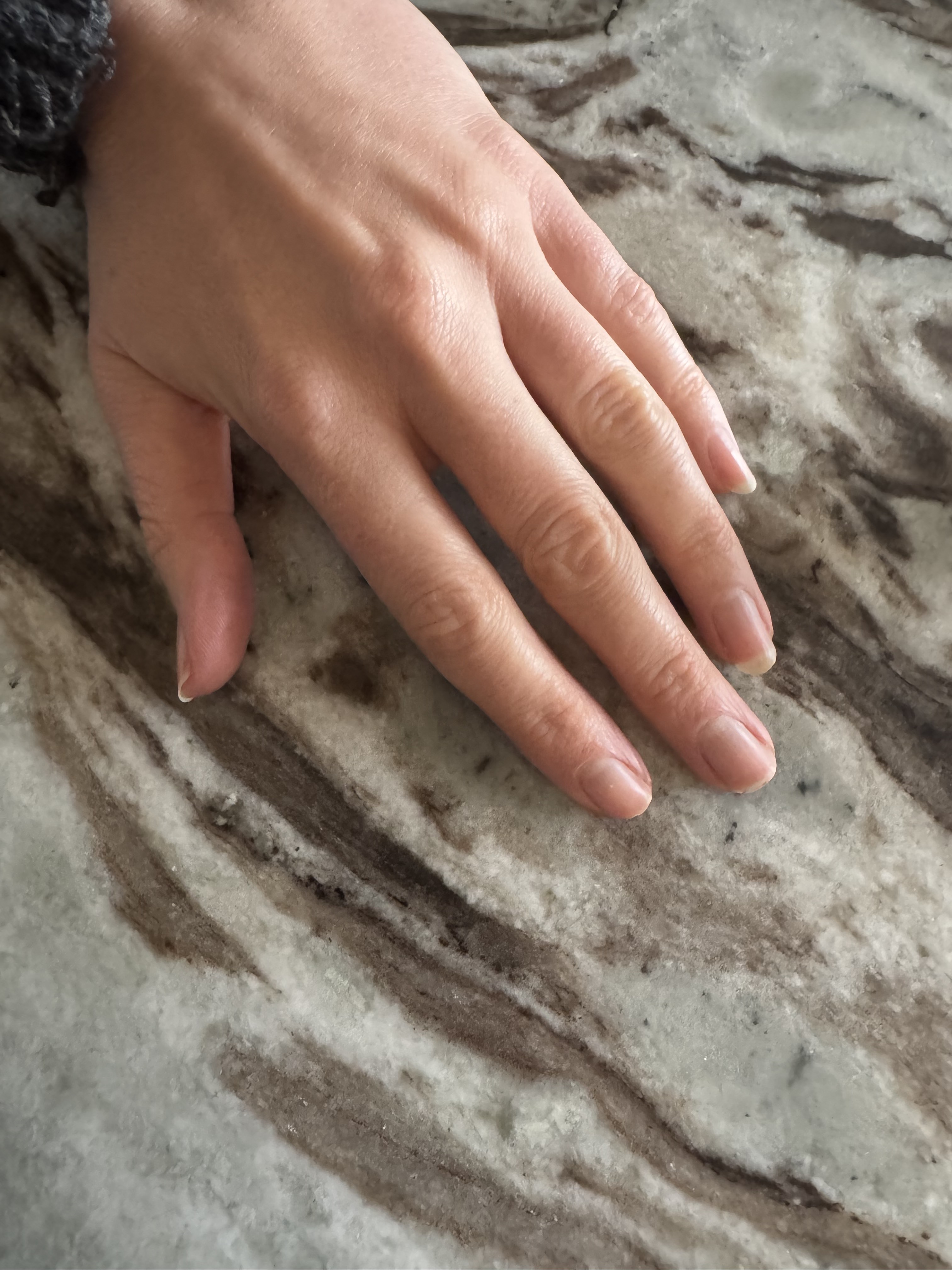 A photo of Eleanor's bare nails before using the manucurist nail serum