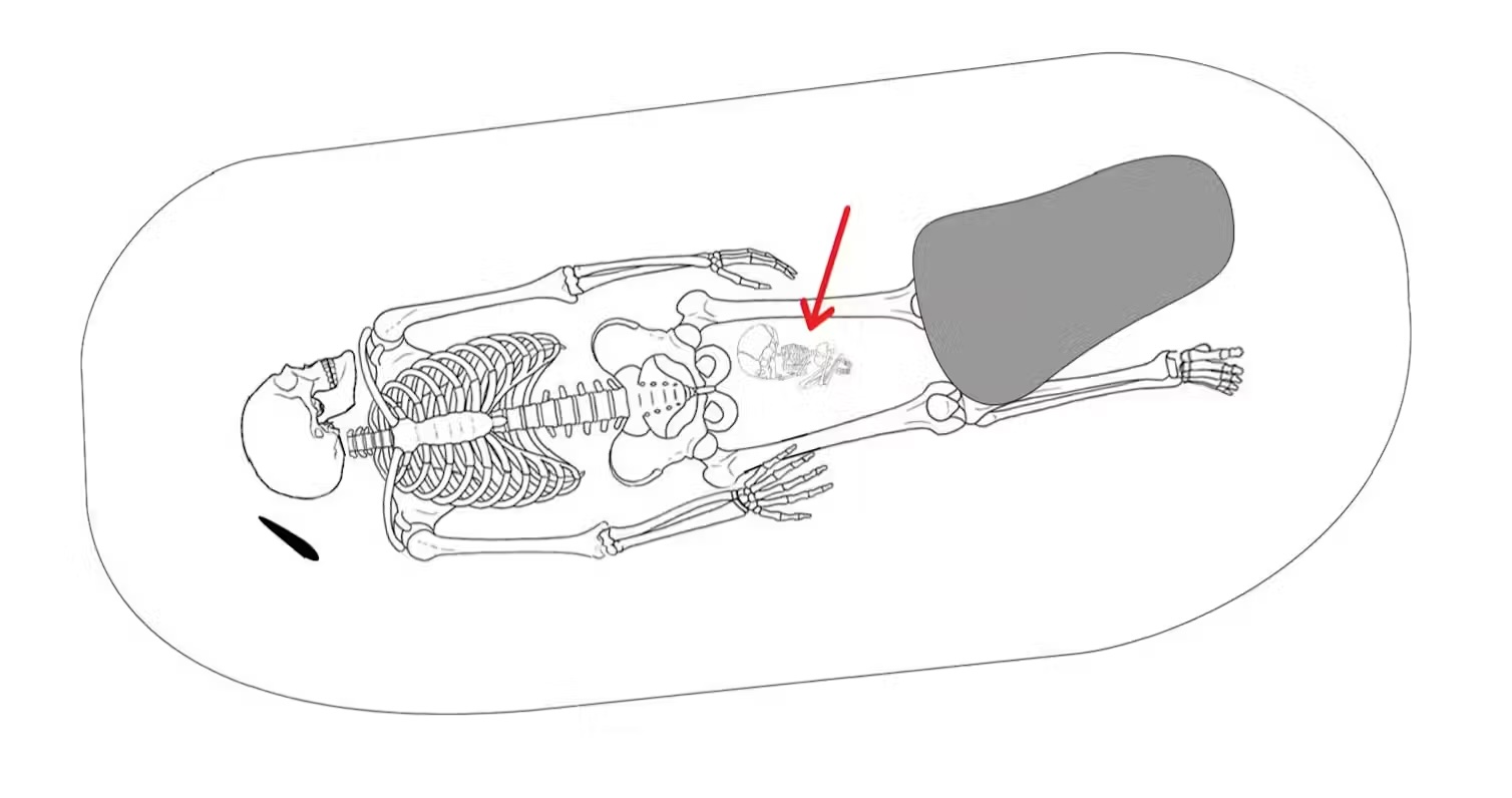 a diagram of a Viking burial showing a female skeleton with a newborn skeleton between her legs