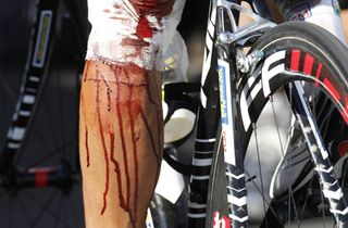 Johnny Hoogerland after a crash on stage nine of the 2011 Tour de France