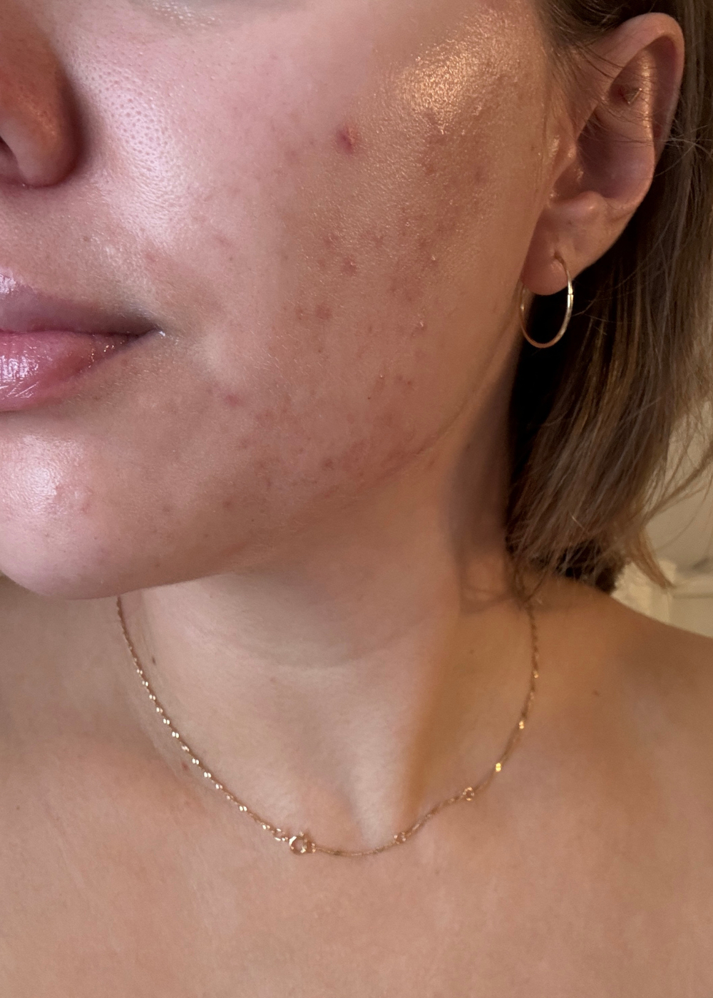 Close up image of beauty editor Rebecca&#039;s skin without make-up