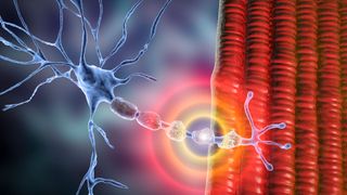 Illustration showing demylination, a process in which the myelin sheath of neurons is damaged. 