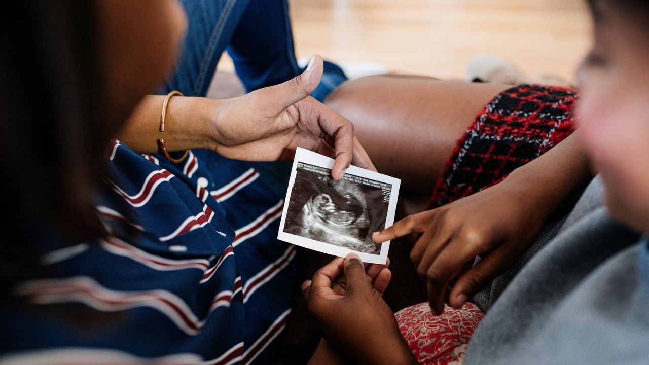 Skull theory illustrated by Women looking at ultrasound scan of baby