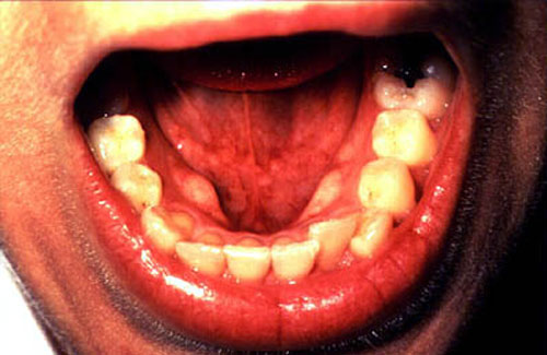 A mouth.