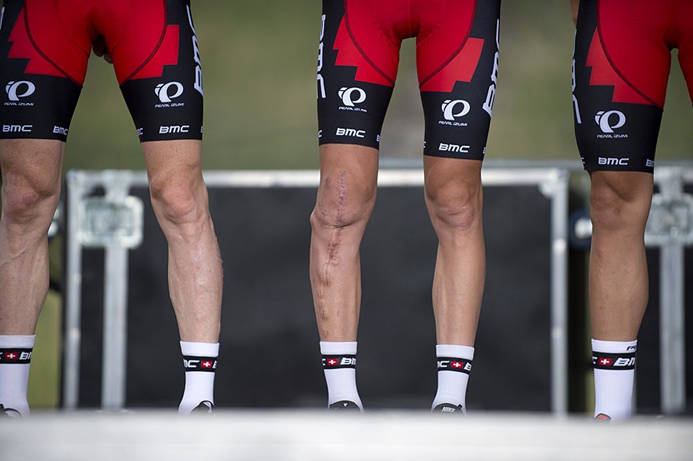 Peter Stetina's (BMC) leg isn't a pretty sight after his big crash at Pa&iacute;s Vasco