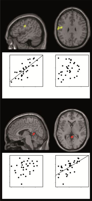 Location of brain regions where grey matter changed with VIQ and PIQ.