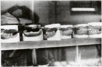 Blurred close-up detail of dental models or casts showing fine textural detail.