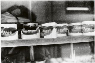 Blurred close-up detail of dental models or casts showing fine textural detail.