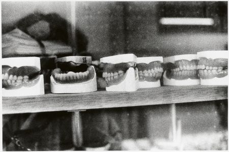 Blurred close-up detail of dental models or casts showing fine textural detail.
