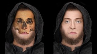 Forensic artists used markers to determine the thickness of skin on the Scottish skulls.